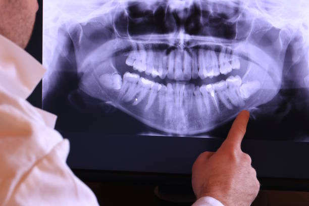 Best Weekend Emergency Dentist in Cortland, NY
